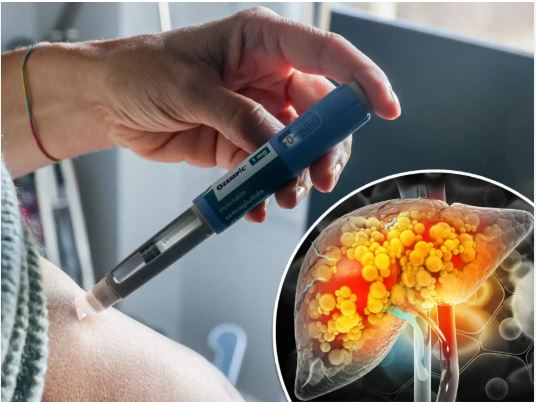 From Heart to Liver: Novel Diabetes Drugs Offer Dual Wings of Protection for High-Risk Patients